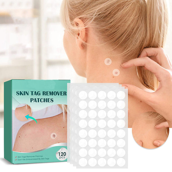 Skin Tag Remover Patches | Verwijder gemakkelijk en effectief irriterende huidlabels-Boetiek Moda