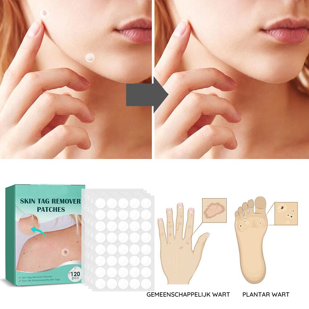 Skin Tag Remover Patches | Verwijder gemakkelijk en effectief irriterende huidlabels-Boetiek Moda