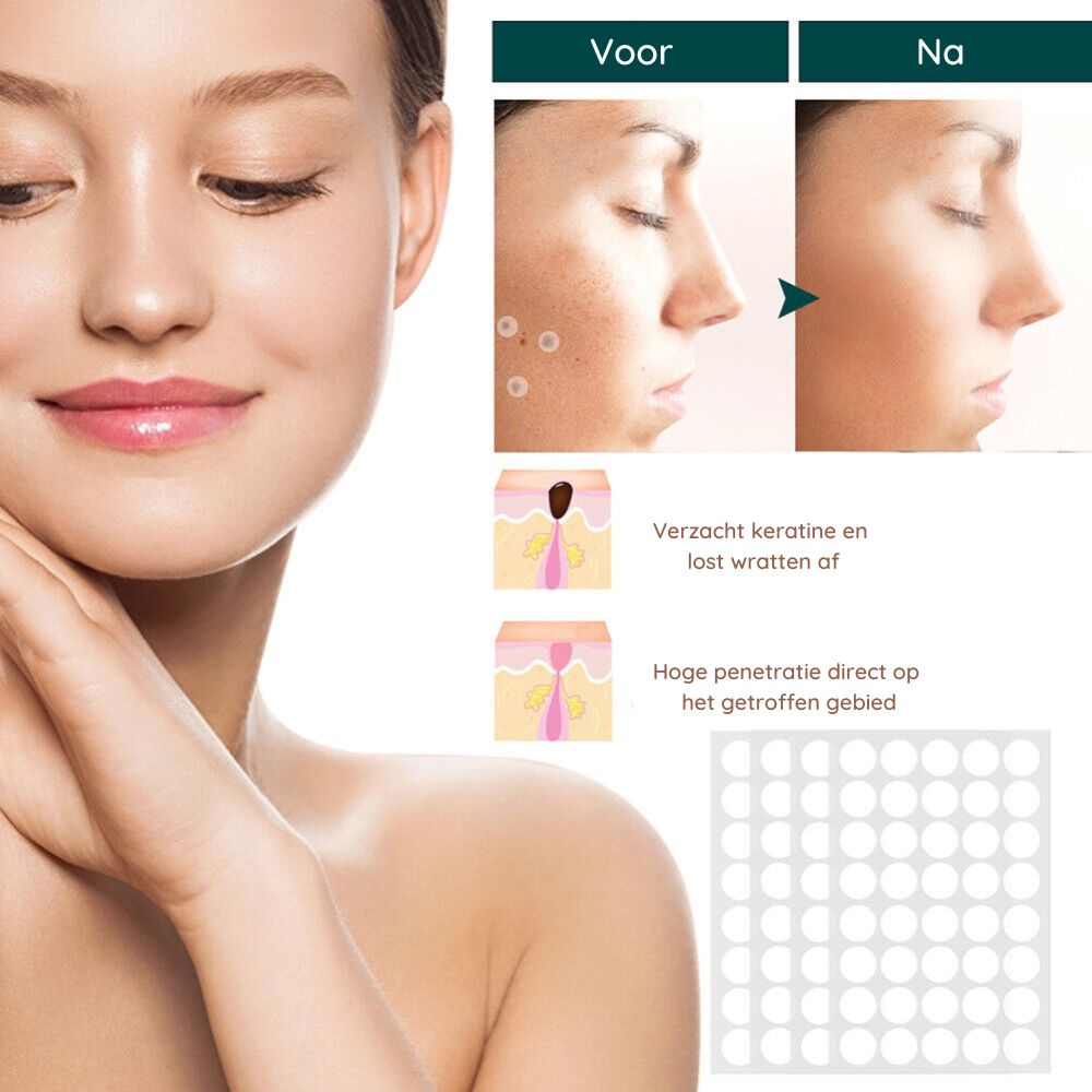 Skin Tag Remover Patches | Verwijder gemakkelijk en effectief irriterende huidlabels-Boetiek Moda