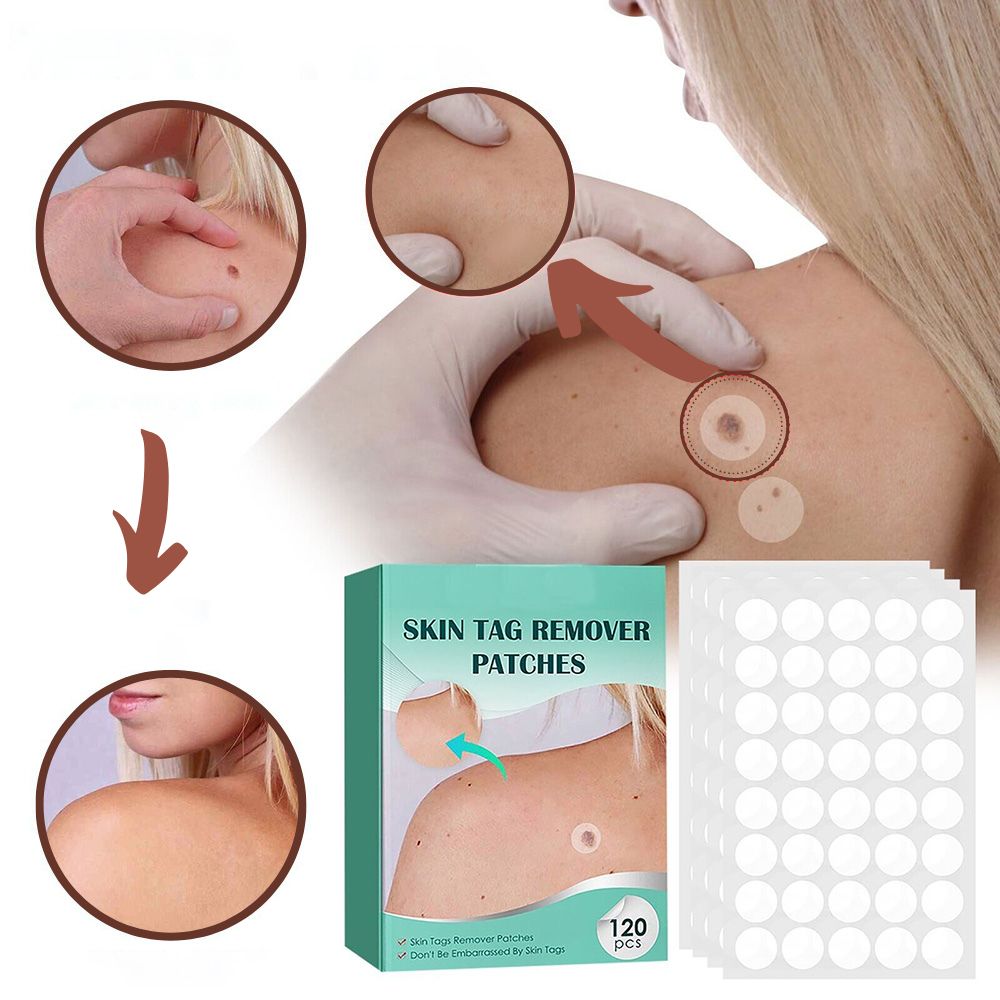 Skin Tag Remover Patches | Verwijder gemakkelijk en effectief irriterende huidlabels-Boetiek Moda