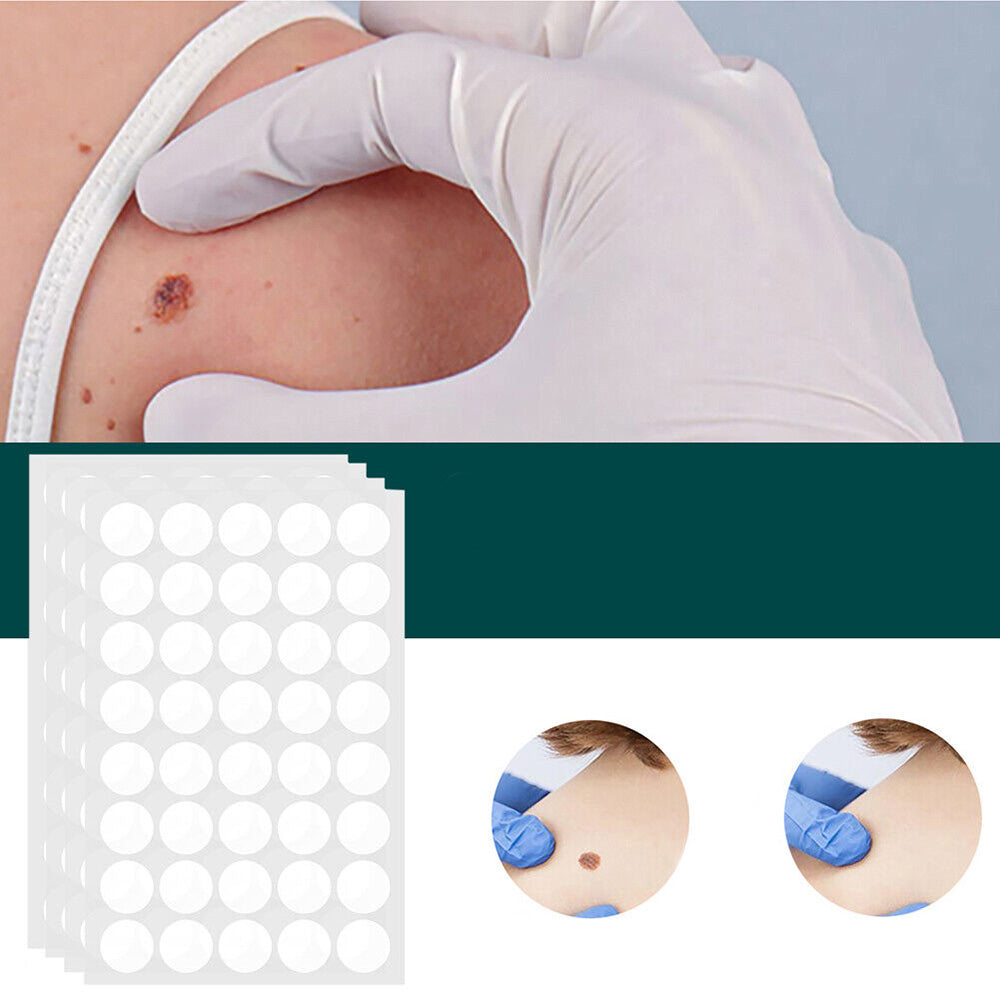 Skin Tag Remover Patches | Verwijder gemakkelijk en effectief irriterende huidlabels-Boetiek Moda