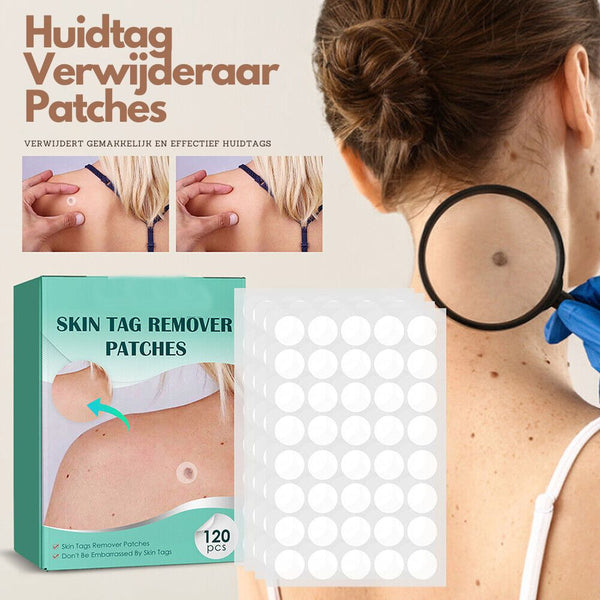 Skin Tag Remover Patches | Verwijder gemakkelijk en effectief irriterende huidlabels-Boetiek Moda